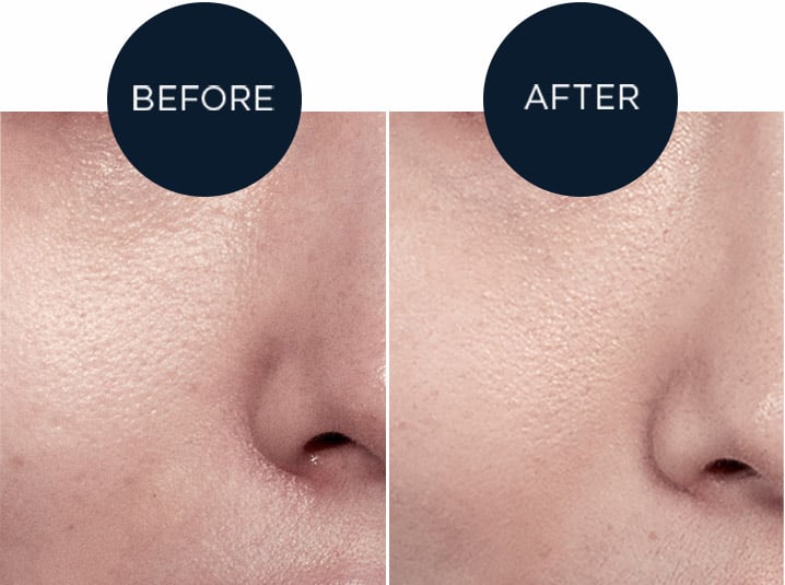 Advanced Génifique Eye Cream