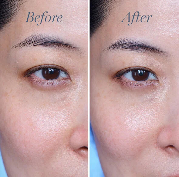 Lancome Advanced Genifique eye cream