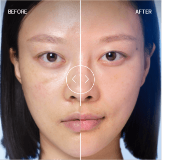 BEFORE / AFTER